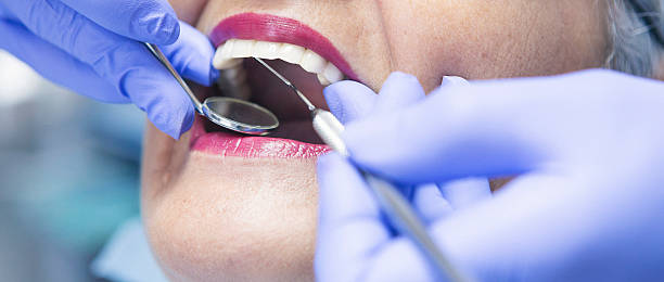 Best Broken Tooth Emergency  in Rosamond, CA